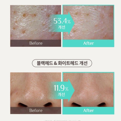 Objet 零毛孔慕斯泥膜 100ml Pore Zero Mousse Clay Pack 100ml